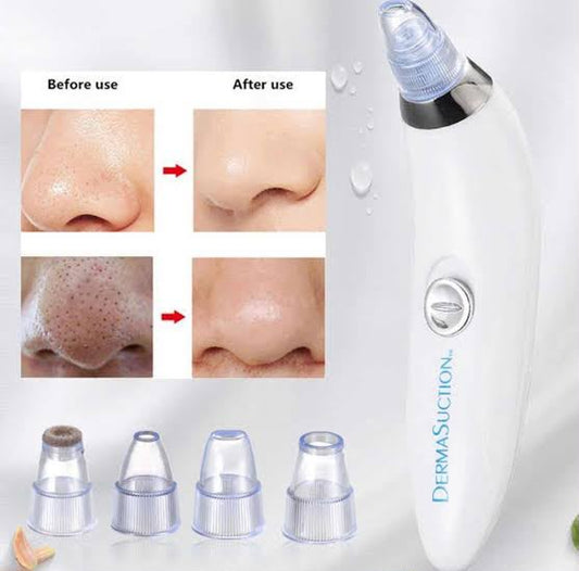 Blackhead Remover Vacuum