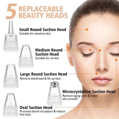 Electric Blackhead Remover Vacuum – Pore Cleaner & Acne Extractor Tool | 5 Suction Heads | Facial Skin Care Device
