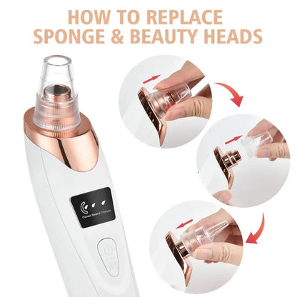 Electric Blackhead Remover Vacuum – Pore Cleaner & Acne Extractor Tool | 5 Suction Heads | Facial Skin Care Device